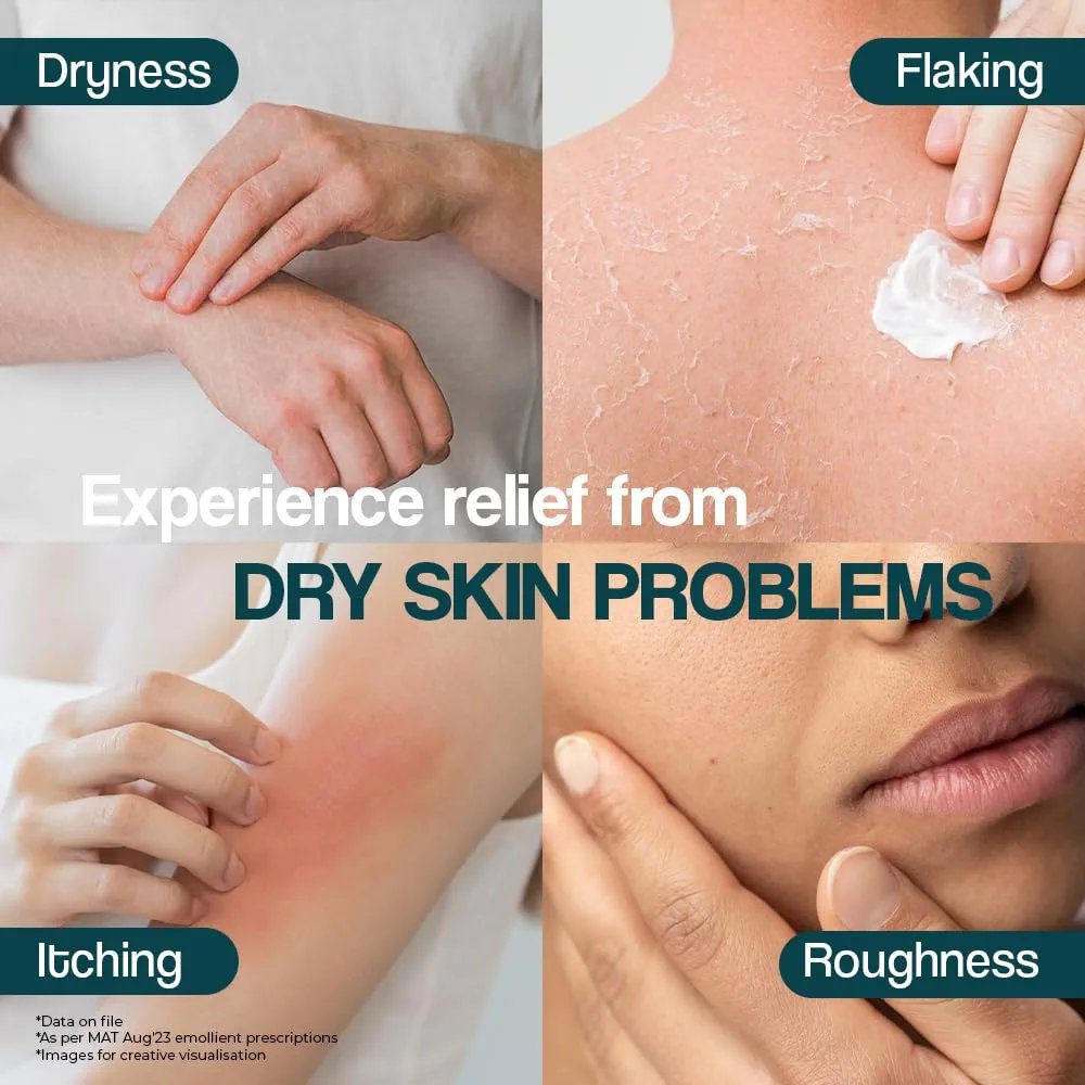 Venusia Max Intensive Moisturizing Cream For Dry Skin To Very Dry Skin, 150 Gm