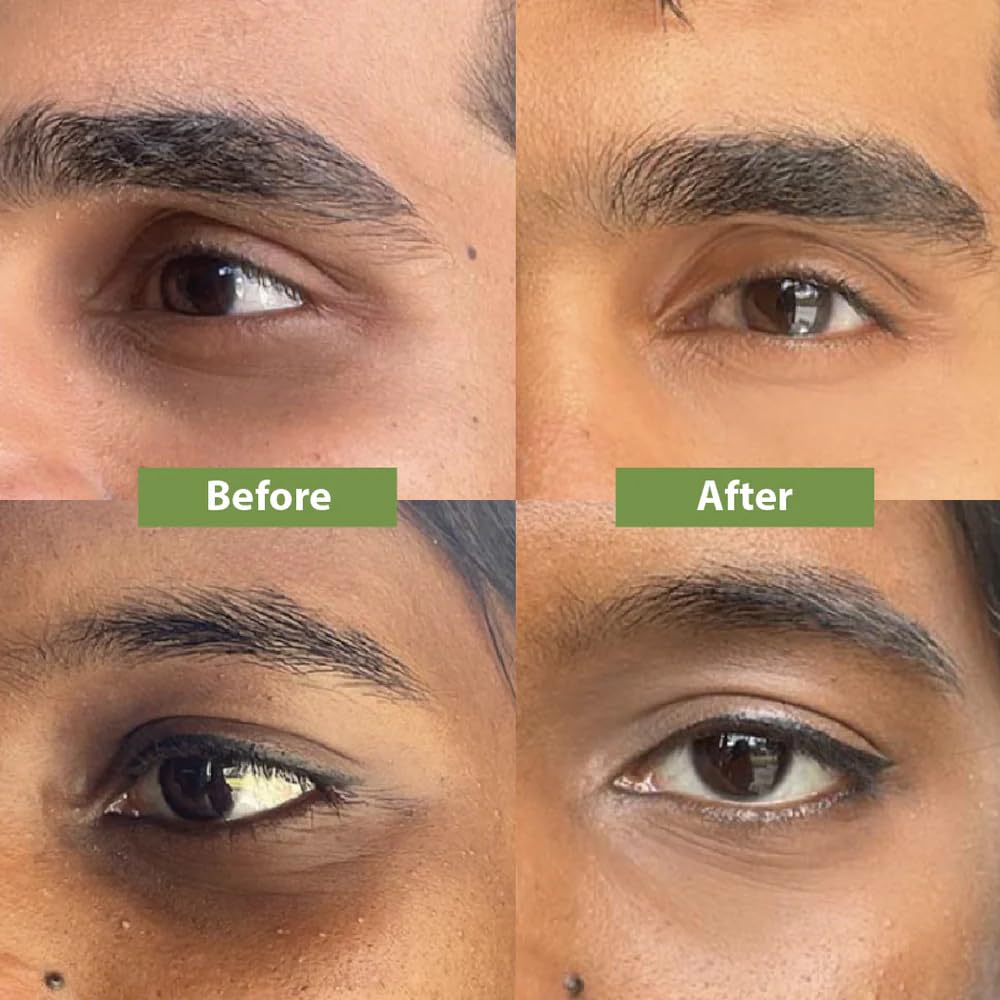Vilvah Store Under Eye Cream | For Dark Circles, Eye Puffiness, Fine Lines & Wrinkles -20ml