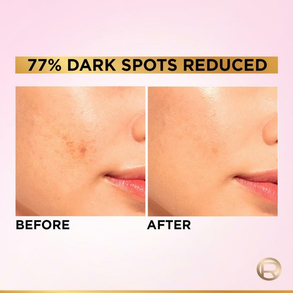 L'Oreal Paris Glycolic Bright 8% [Melasyl + Niacinamide] Face Serum for Brightening Dark Spots 30ml