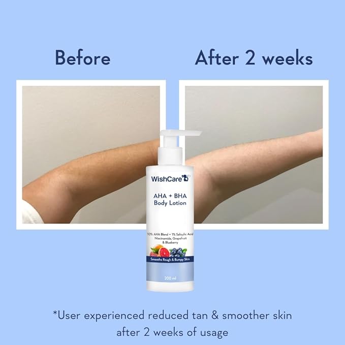 WishCare 10% AHA + 1% BHA Body Lotion – Smooth & Hydrate Rough, Dry Skin (200ml)