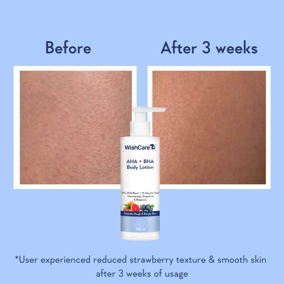 WishCare 10% AHA + 1% BHA Body Lotion