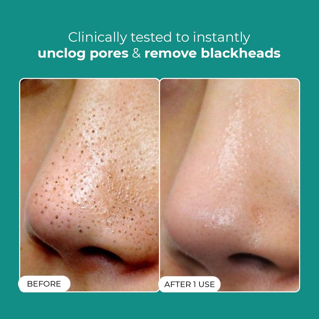 Conscious Chemist® Blackhead Melting Water | 130ml