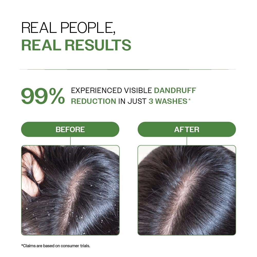 Bare Anatomy Expert Anti-Dandruff Shampoo with Salicylic Acid & Biotin - 250 ml