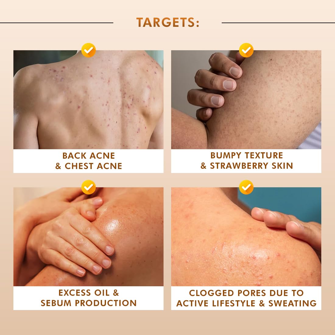 mCaffeine Exfoliating Body Wash for Smooth, Clear Skin (300ml)