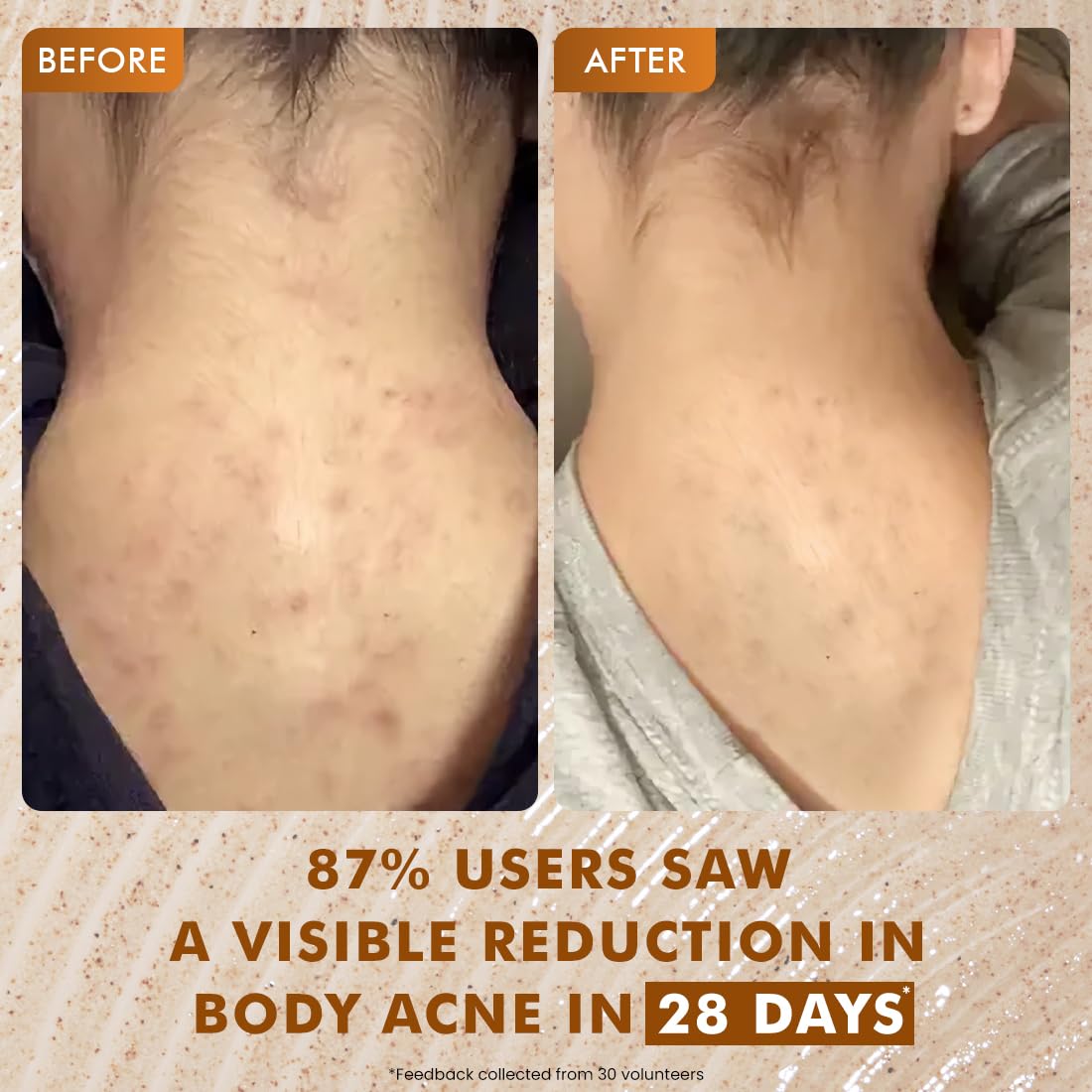 mCaffeine Exfoliating Body Wash for Smooth, Clear Skin (300ml)