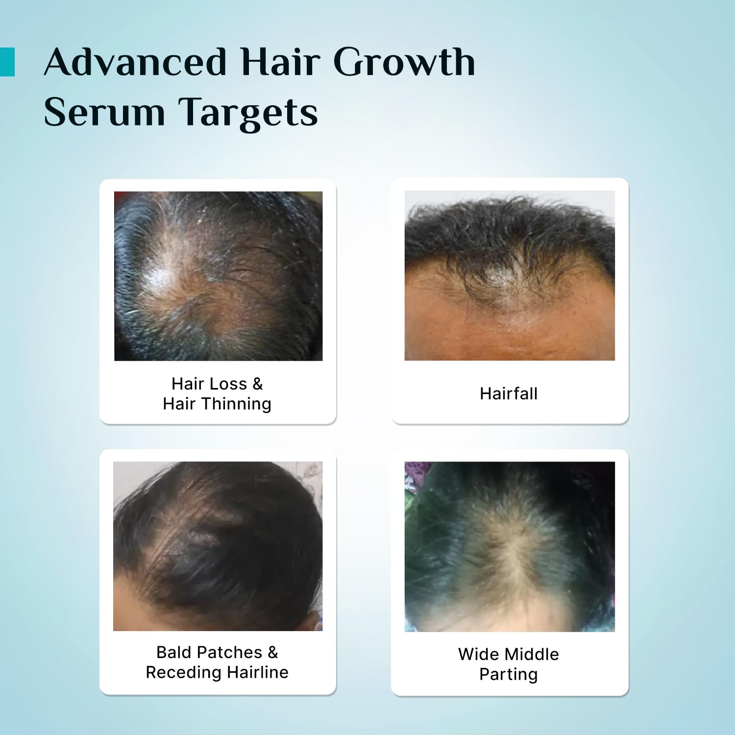 Pilgrim Hair Growth Serum with Redensyl, Anagain & Baicapil