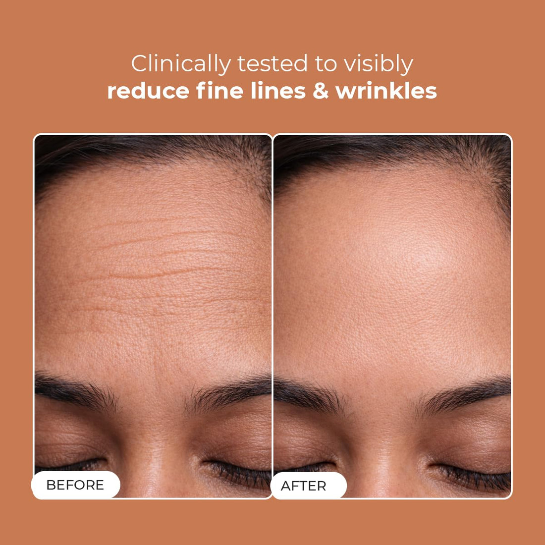 Conscious Chemist 0.2% Retinol Moisturizer Cream | 50g