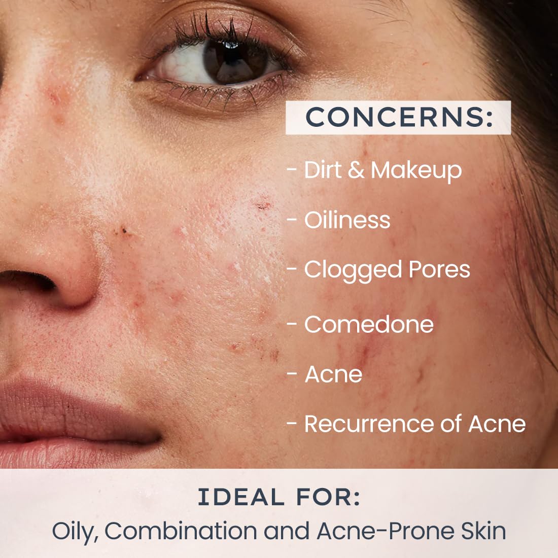 Hyphen Oil Control Face Wash with 2% AHA+BHA & Niacinamide