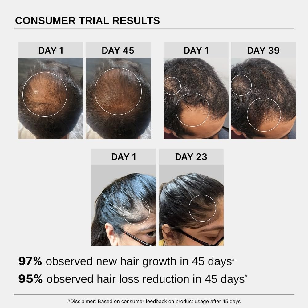 Bare Anatomy Advanced Hair Growth Serum - Hair growth & Hair fall control serum for Women & Men | 30mL
