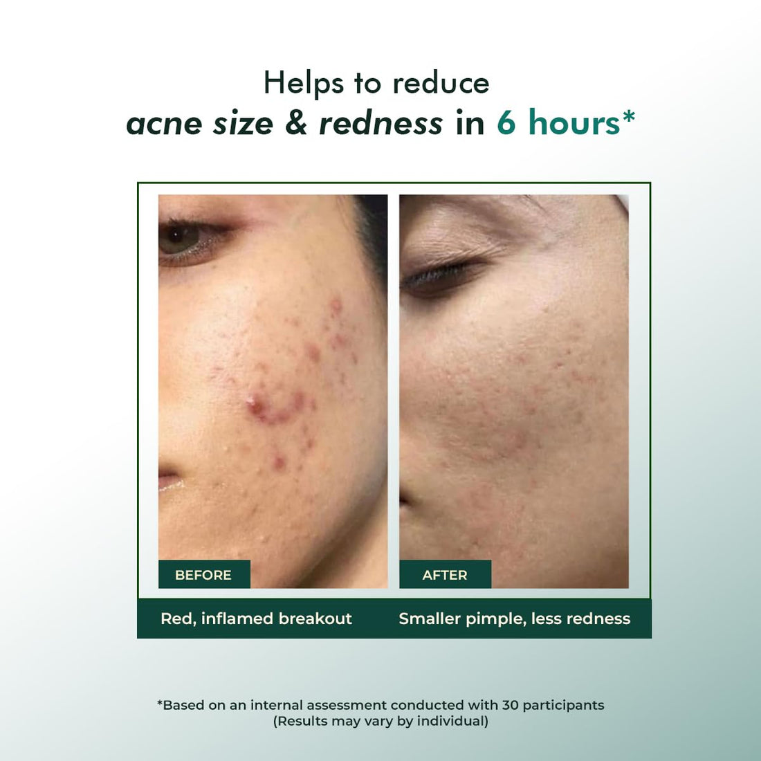 Conscious Chemist Rapid Relief Acne Spot Corrector Gel
