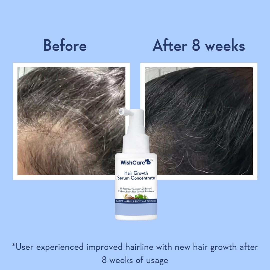 WishCare Hair Growth Serum Concentrate - 30ml