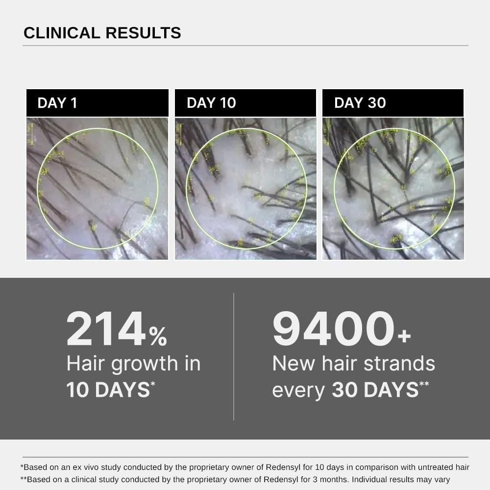 Bare Anatomy Advanced Hair Growth Serum - Hair growth & Hair fall control serum for Women & Men | 30mL