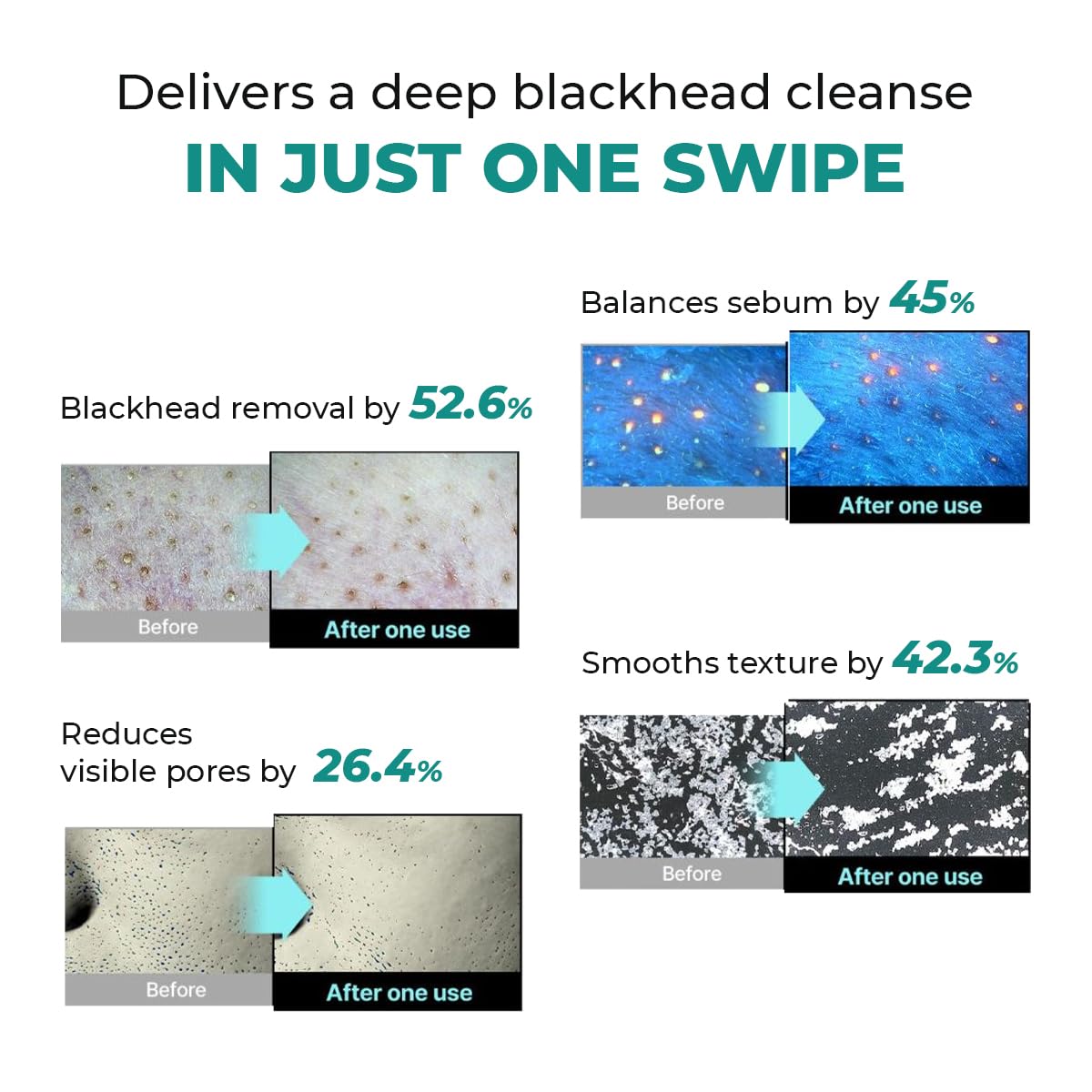 Conscious Chemist® Blackhead Melting Water | 130ml
