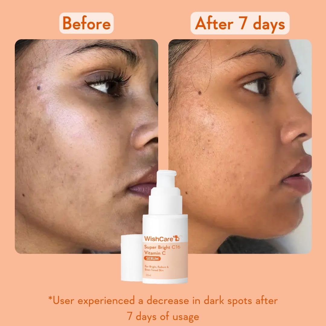 WishCare Super Bright C16 Vitamin C Serum For Oily Skin - 30Ml