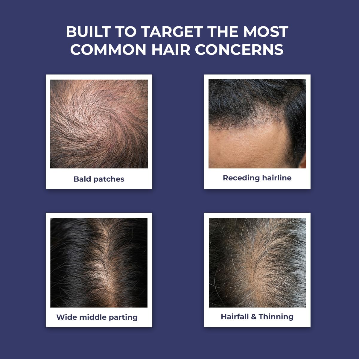 Conscious Chemist® Anti Hairfall Shampoo - 200ml