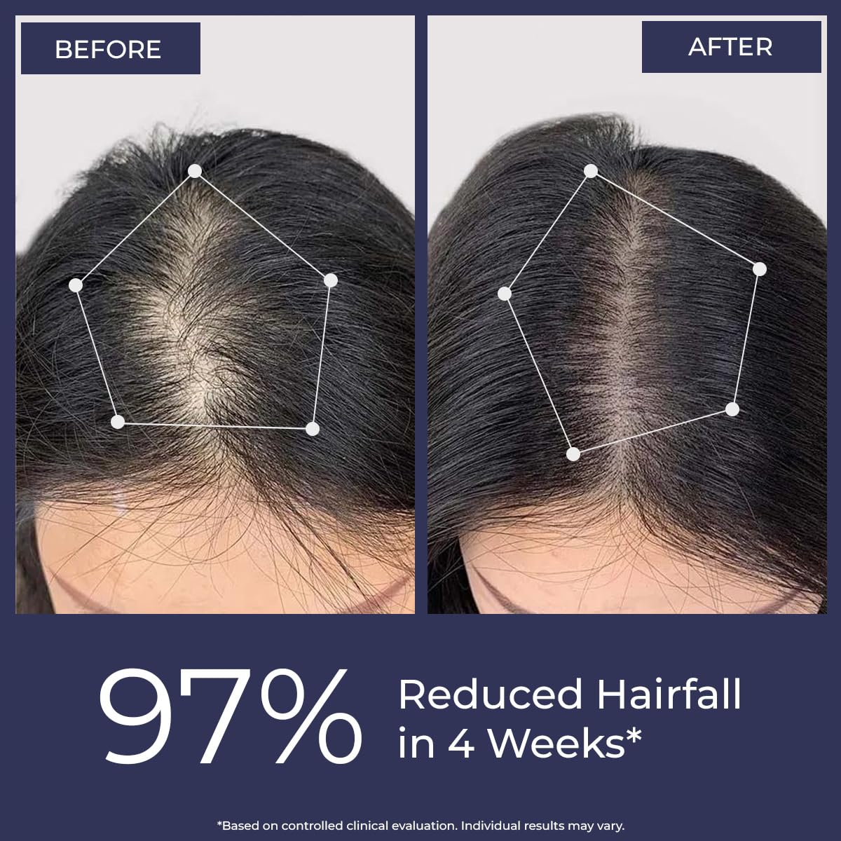Conscious Chemist® Rosemary Water Spray for Hair Growth - 200ml