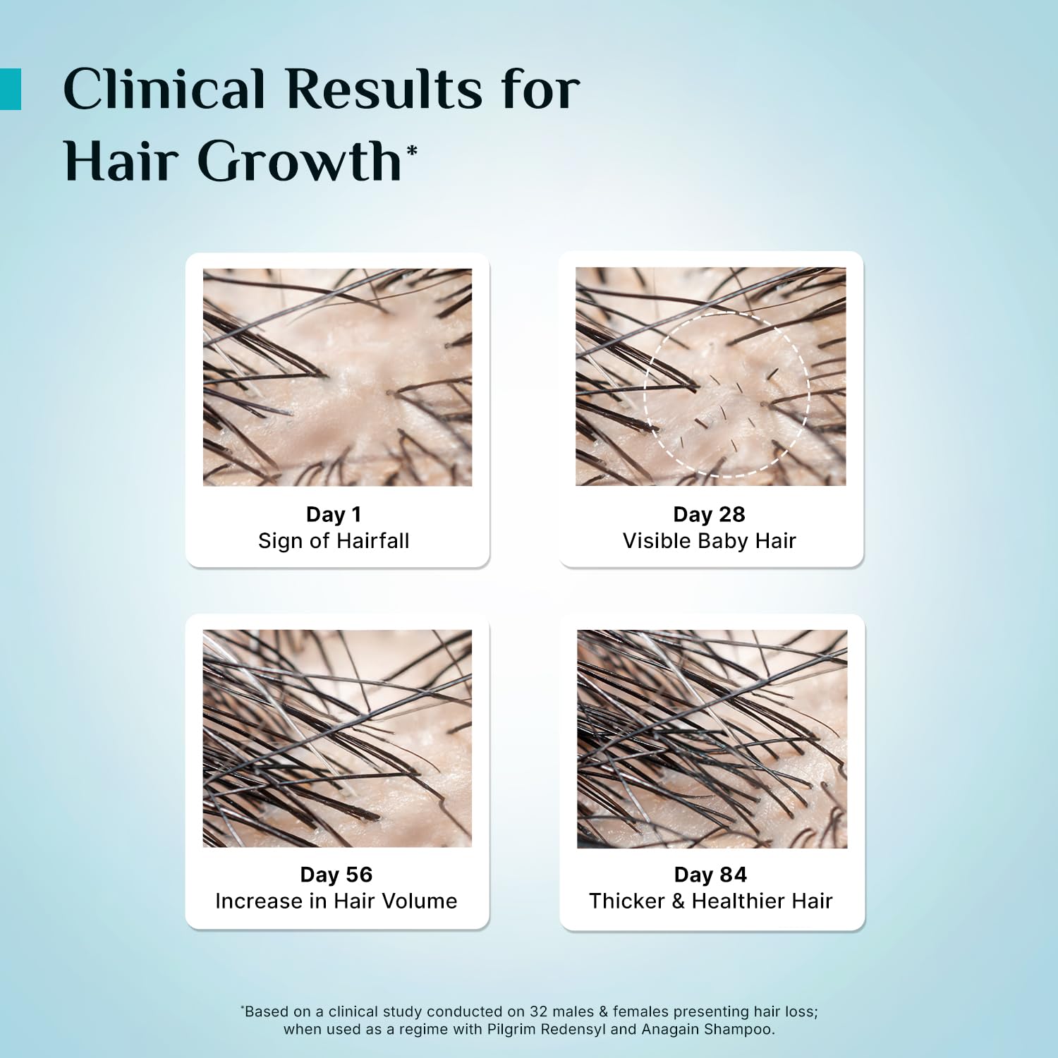 Pilgrim Hair Growth Serum with Redensyl, Anagain & Baicapil