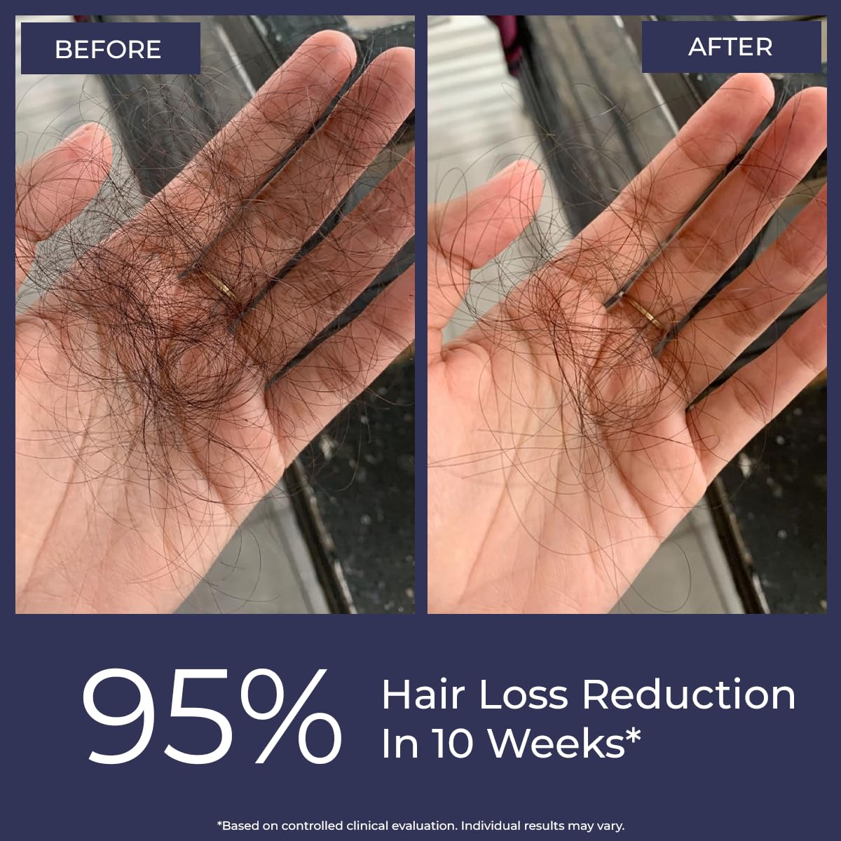 Conscious Chemist® Hair Growth & Anti Hair Fall Serum - 30ml