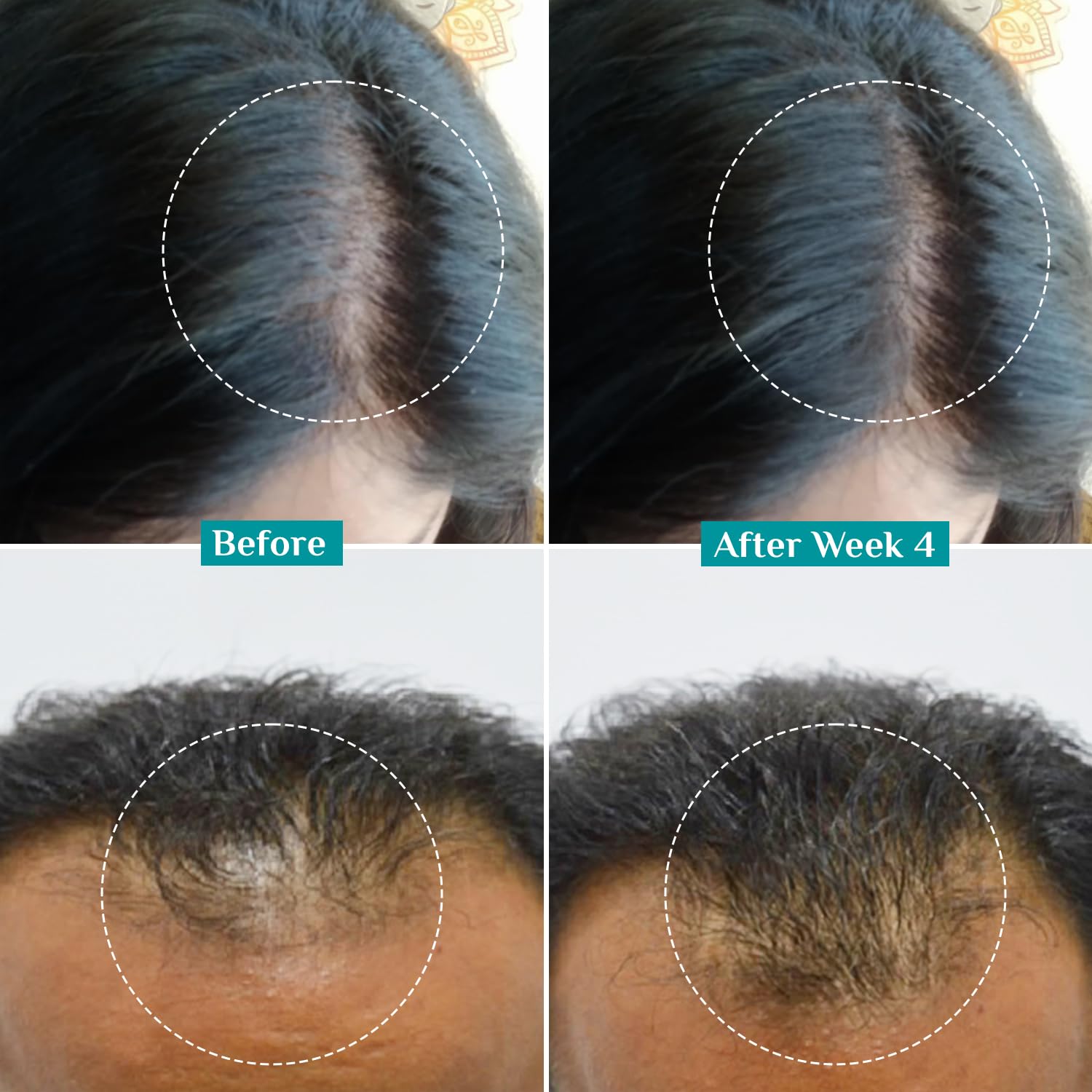 Pilgrim Hair Growth Serum with Redensyl, Anagain & Baicapil
