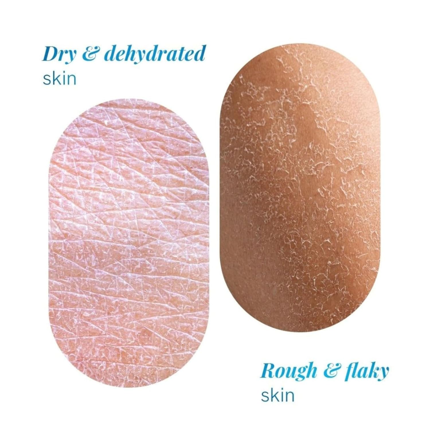 Be Bodywise 10% Urea Body Lotion 300ml