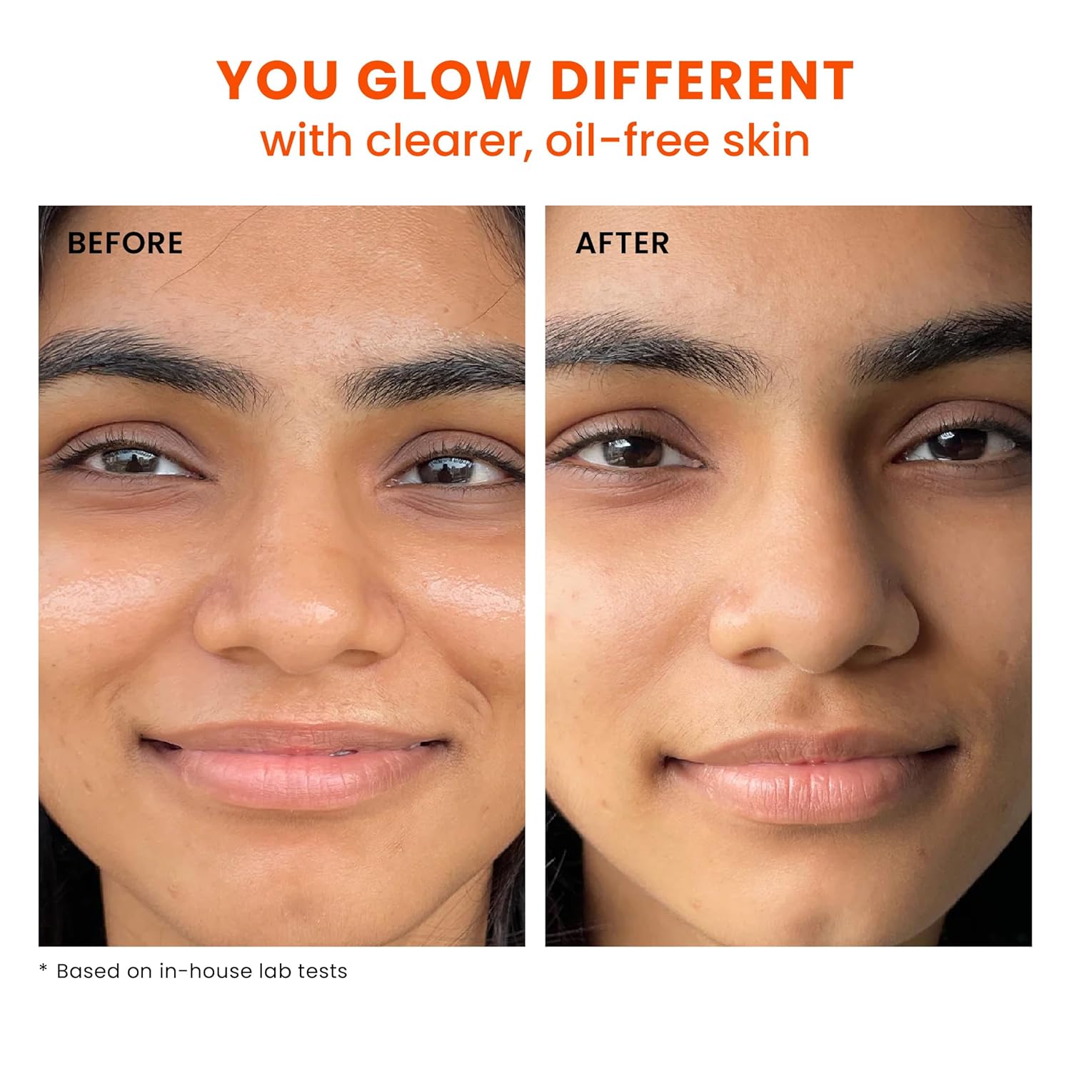 Foxtale SPF 70 Gel-Cream Sunscreen for Oily Skin