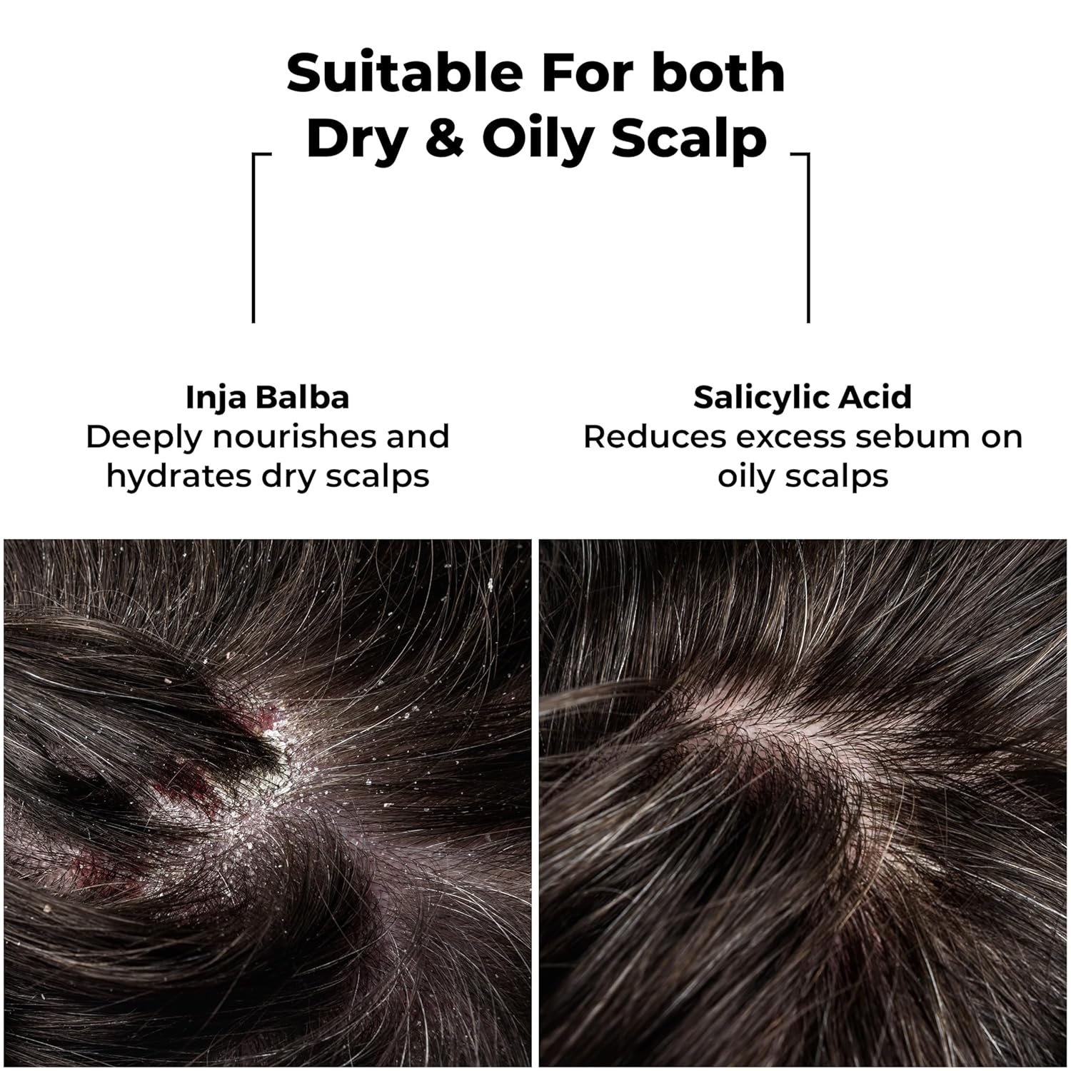 Brillare Professional Dandruff Control Shampoo With Salicylic Acid