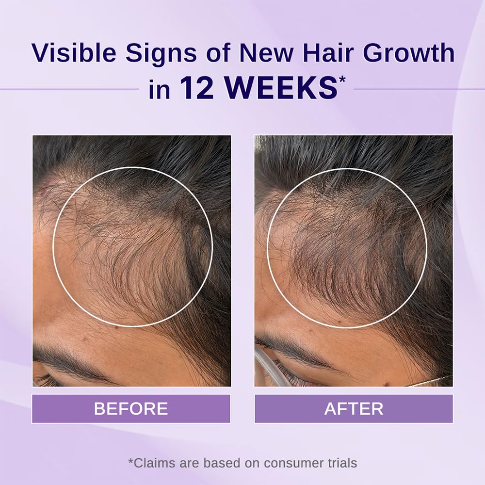 Bare Anatomy Rosemary Hibiscus Hair Growth Oil 100ml