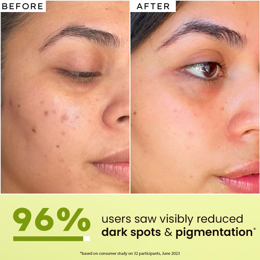Hyphen Brightening Niacinamide & Arbutin Serum 30ml