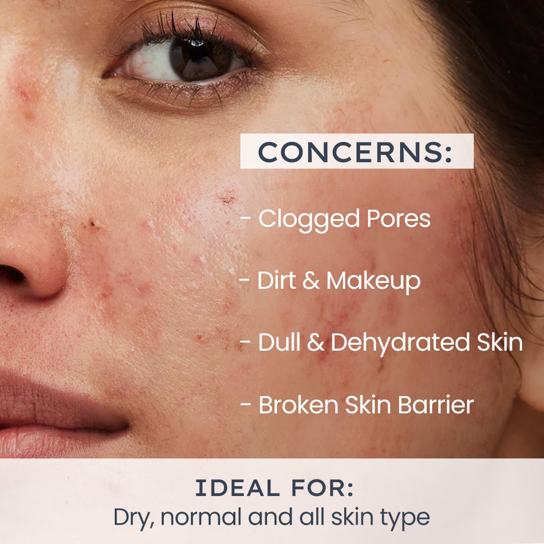 Hyphen Creamy Cleanser with Ceramides & Hydration (100ml)