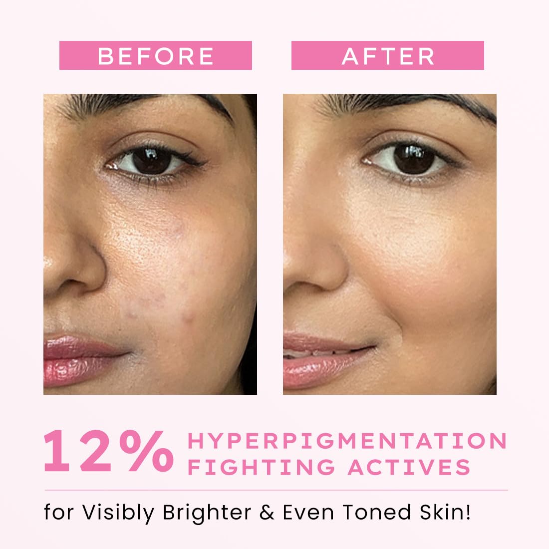 Hyphen De-Pigmentation Serum 2% Kojic Acid – 30ml