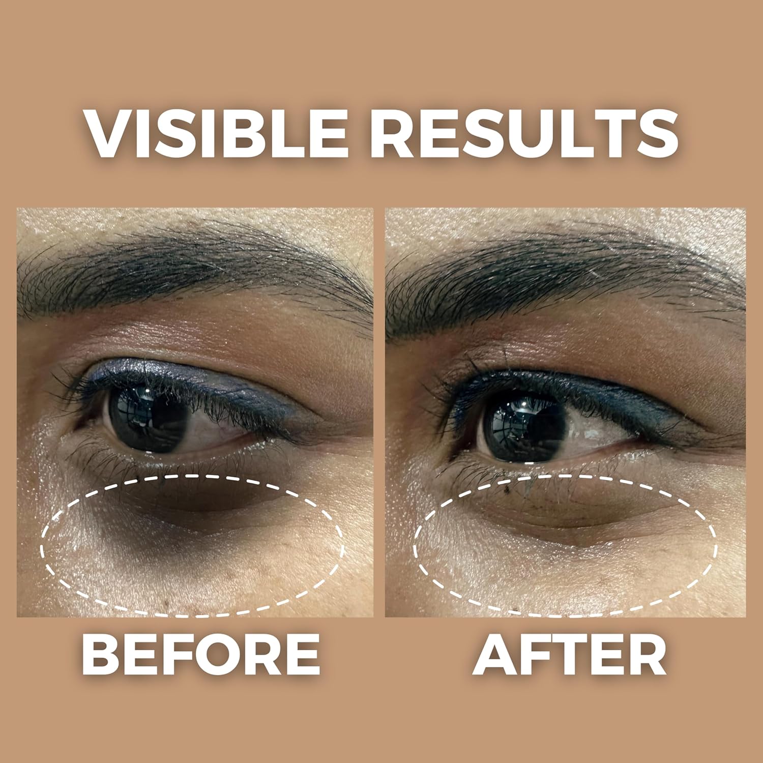 The Tribe Concepts Under Eye Brightening Oil 8ml