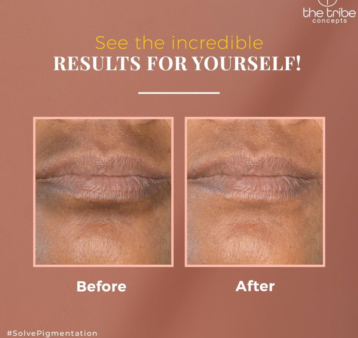 The Tribe Concepts Anti Pigmentation &amp; Toning Mask