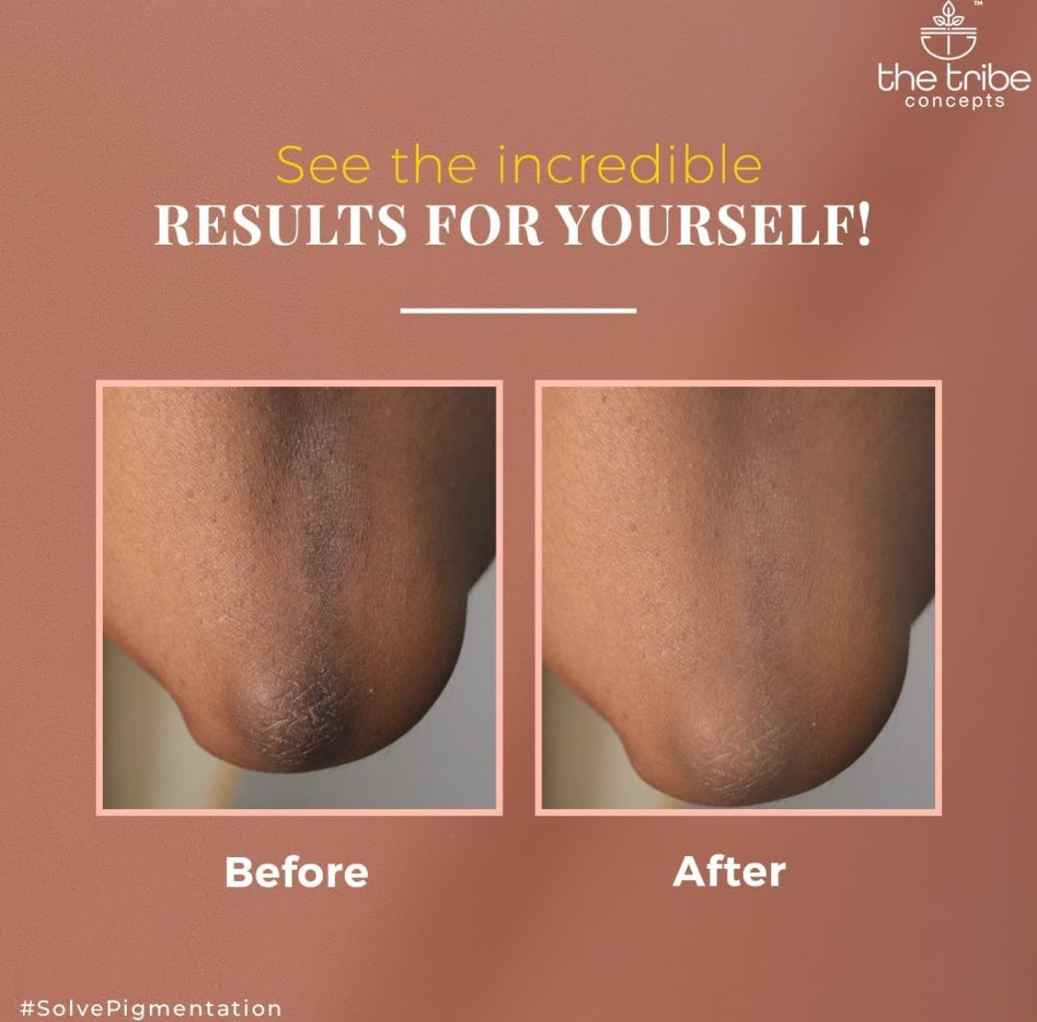 The Tribe Concepts Anti Pigmentation &amp; Toning Mask